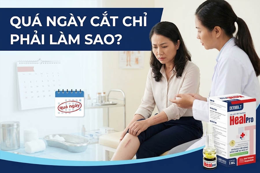 Quá ngày cắt chỉ phải làm sao?