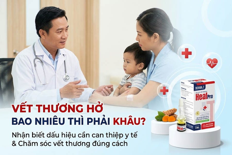 Vết thương hở bao nhiêu thì phải khâu?